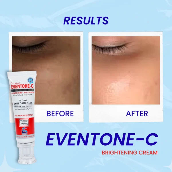 Eventone C Cream For Skin Brightening & Glowing
