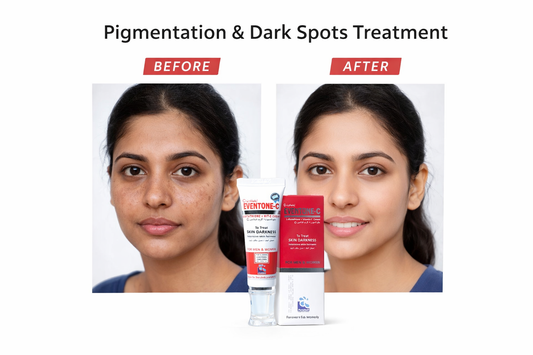 Eventone C Cream For Skin Brightening & Glowing